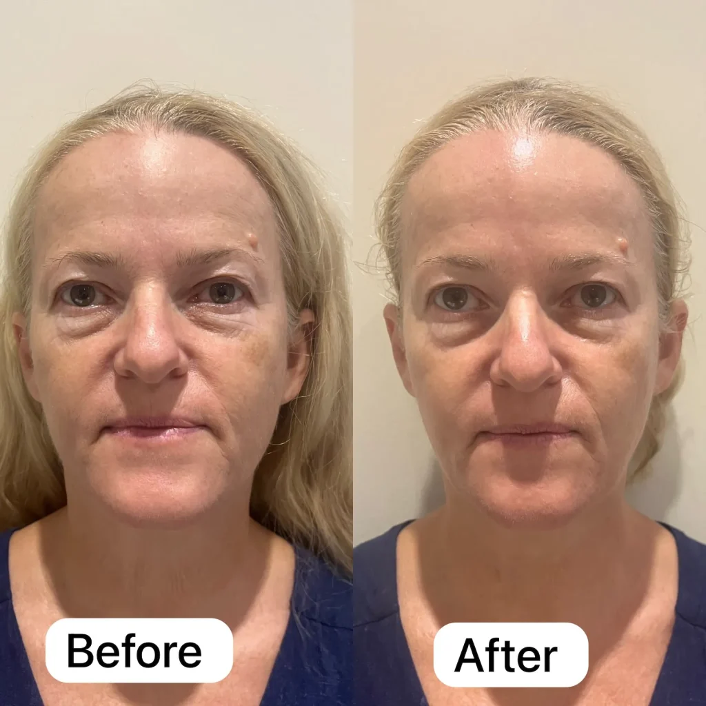processed-62F9E501-7032-438C-8523-B7B6FD5B789B